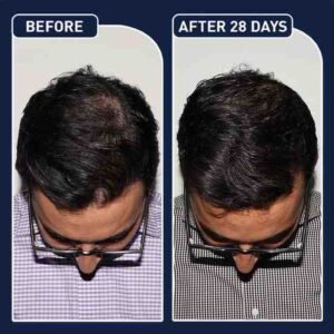 FEGPlus Minoxidil Beard & Hair Growth Serum